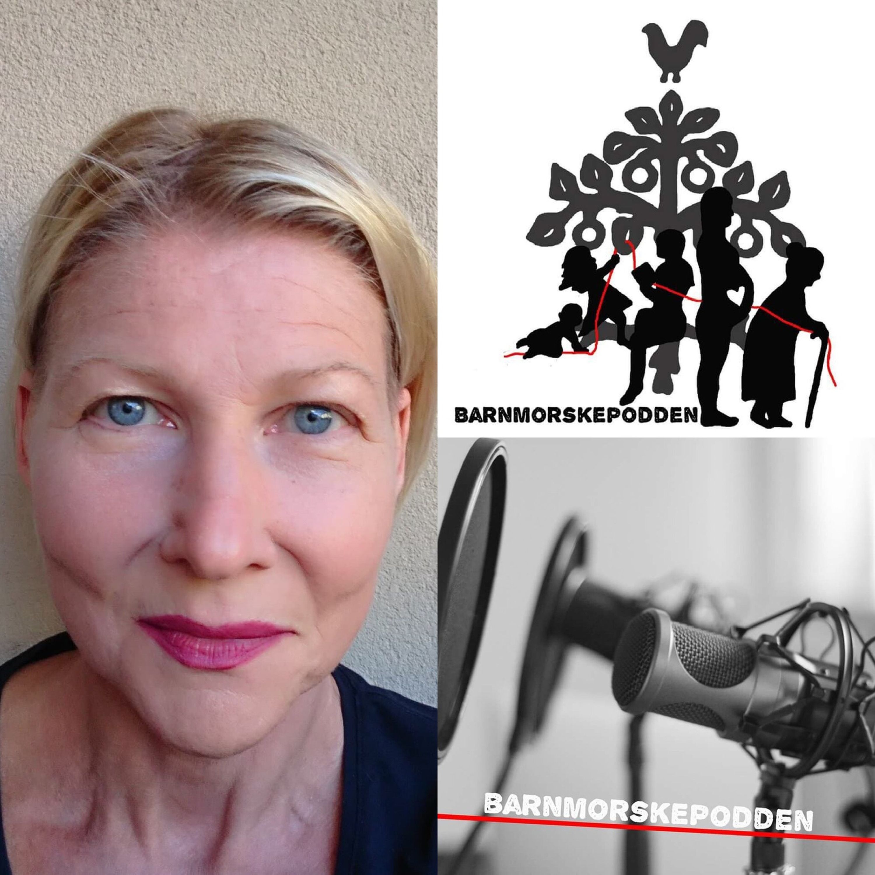 86. "Vulva smärta"