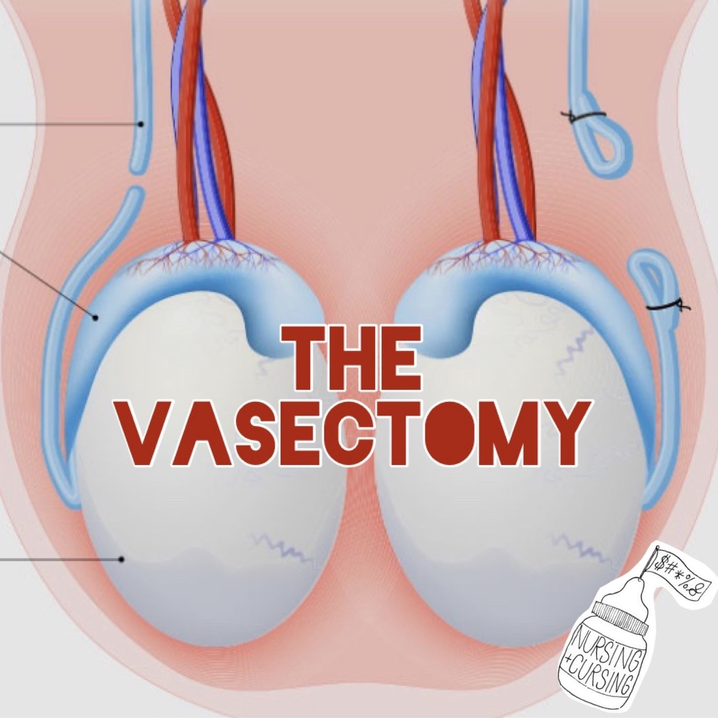 S5 Ep9: THE VASECTOMY