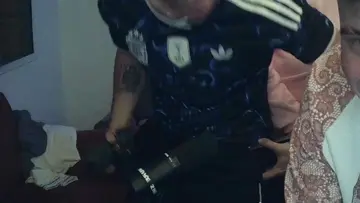 LE ROMPIO LA NUEZ
