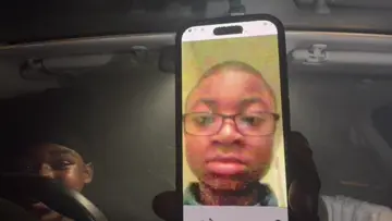 Franklin turtle ahh head 😂😂