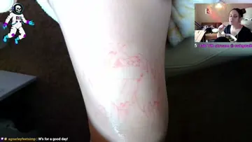 Toes