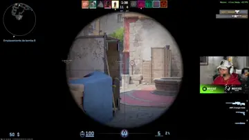 Gg Noscope