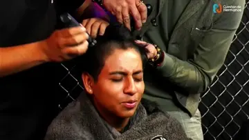 eso es doloroso