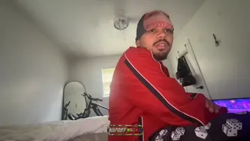 nappdif