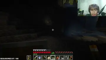 yo soy el xray JASDJAS amigo que suerte 