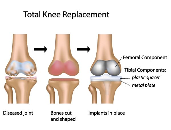10% Off On All #Surgeries S.G.R.Orthopaedic & Multi Specialt
