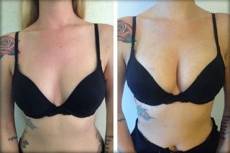 Get Bigger Breasts Naturally Visible Results In 30 Days
