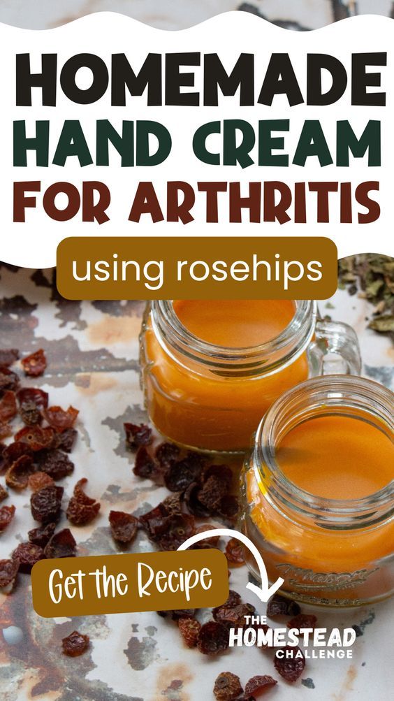 Ease your joint pain naturally with a homemade Arthritis Bal