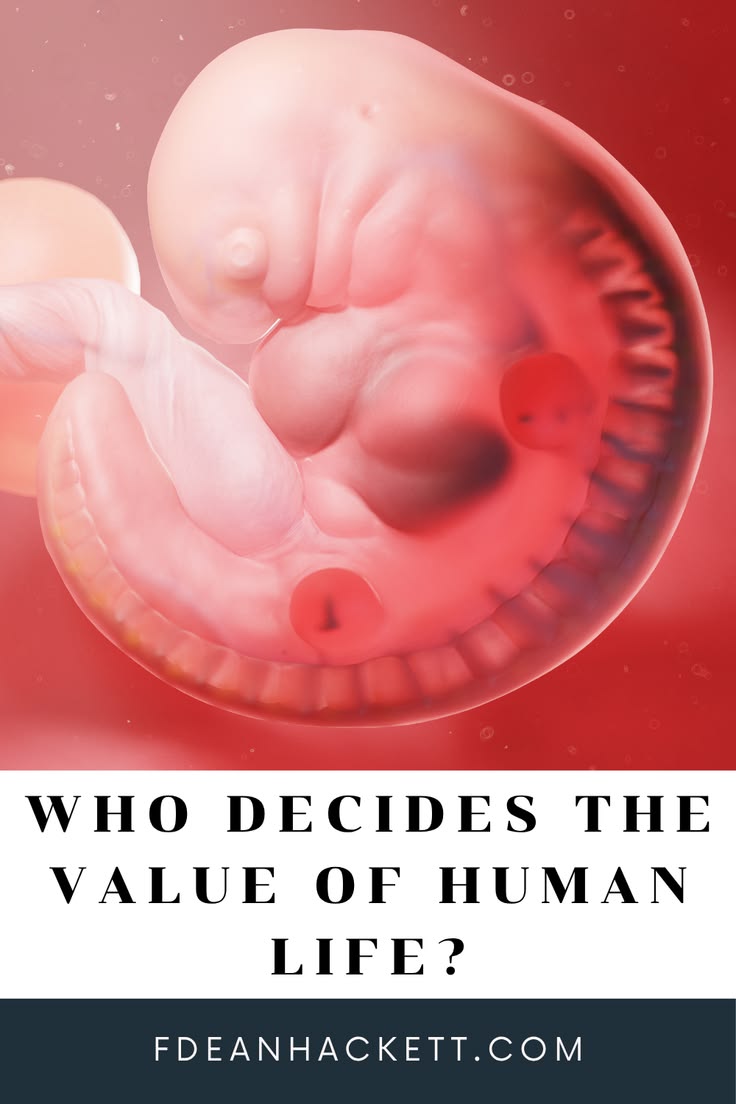 What determines the value of human life? The Bible gives us 