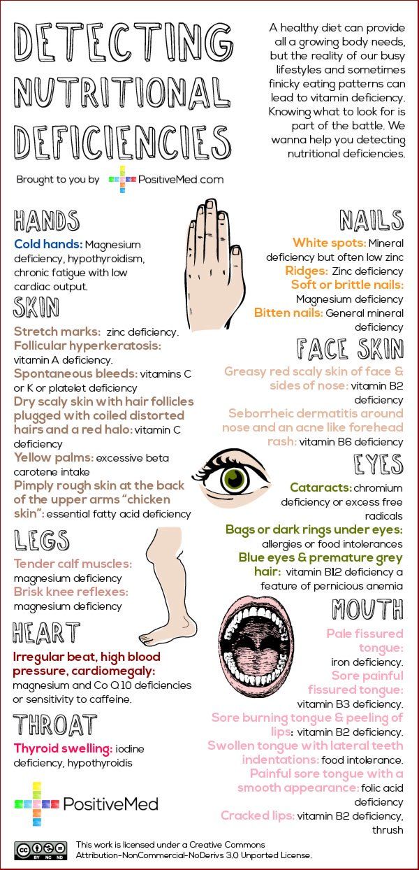 #NutritionalDeficiencies #deficiencies #nutrition #health #M