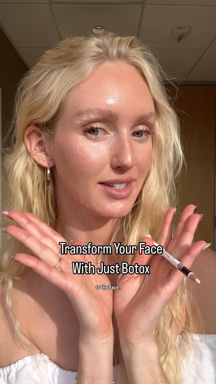 Botox can do SO much more than just getting rid of wrinkles!