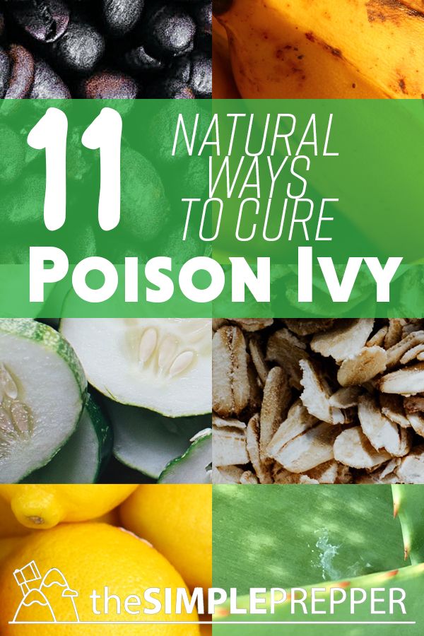 Poison Ivy is the WORST!  Check out these 11 ways to cure to