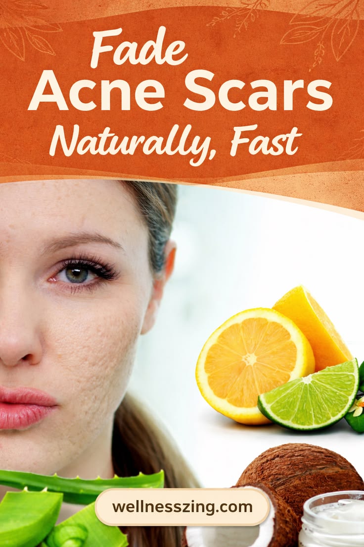 Using natural remedies like coconut oil, cucumber, aloe vera