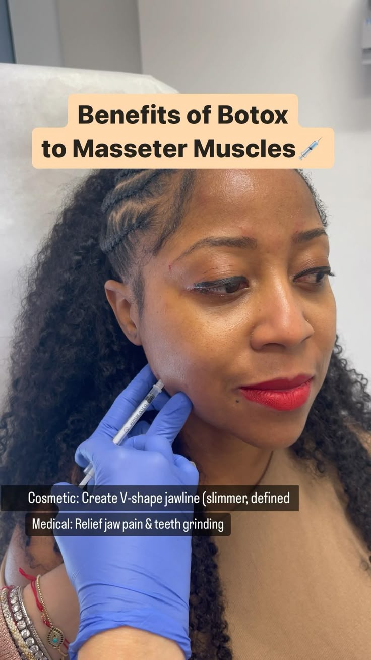 𝗠𝗮𝘀𝘀𝗲𝘁𝗲𝗿 𝗕𝗼𝘁𝗼𝘅// 𝗕𝗲𝗻𝗲𝗳𝗶𝘁𝘀 𝗮𝗻𝗱 𝗥𝗶𝘀𝗸s Masseter Botox is a proc