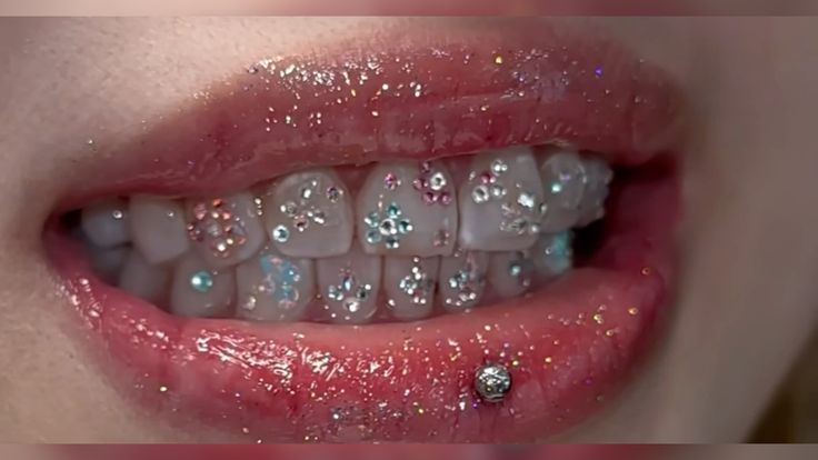 Tooth gem, tooth gem aesthetic #tooth #toothgems #jewelry #s