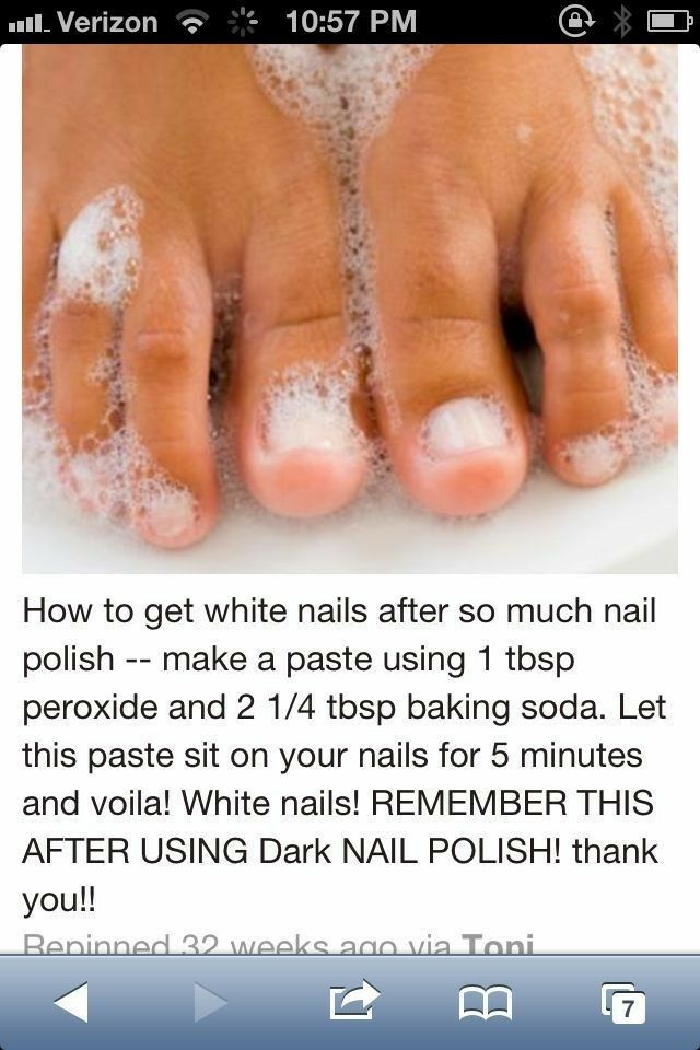 Whiten dark or stained nails #fingernails #toenails #whiten 