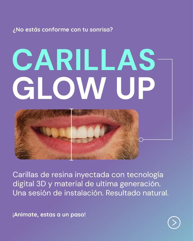 ¿No te gusta tu sonrisa? Hace un cambio natural y rápido. En