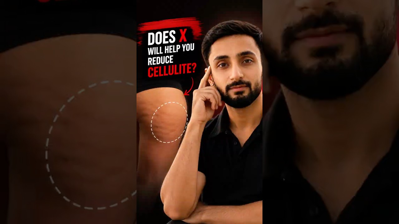 Cellulite Explained: Why 80-90% of Women Have It (Even If They’re Lean)