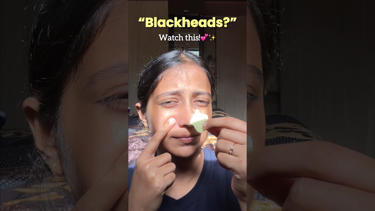 "Blackheads?" Try this📌✨#youtubeshorts #blackheads #skincare #viral #diyskincare