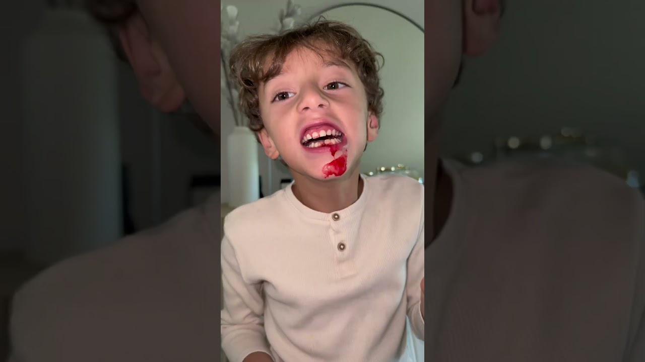 Stefano perdió 2 dientes por accidente 😱😳 #vlog #vlogfamiliar #mividadiaria #momlife #maternidad