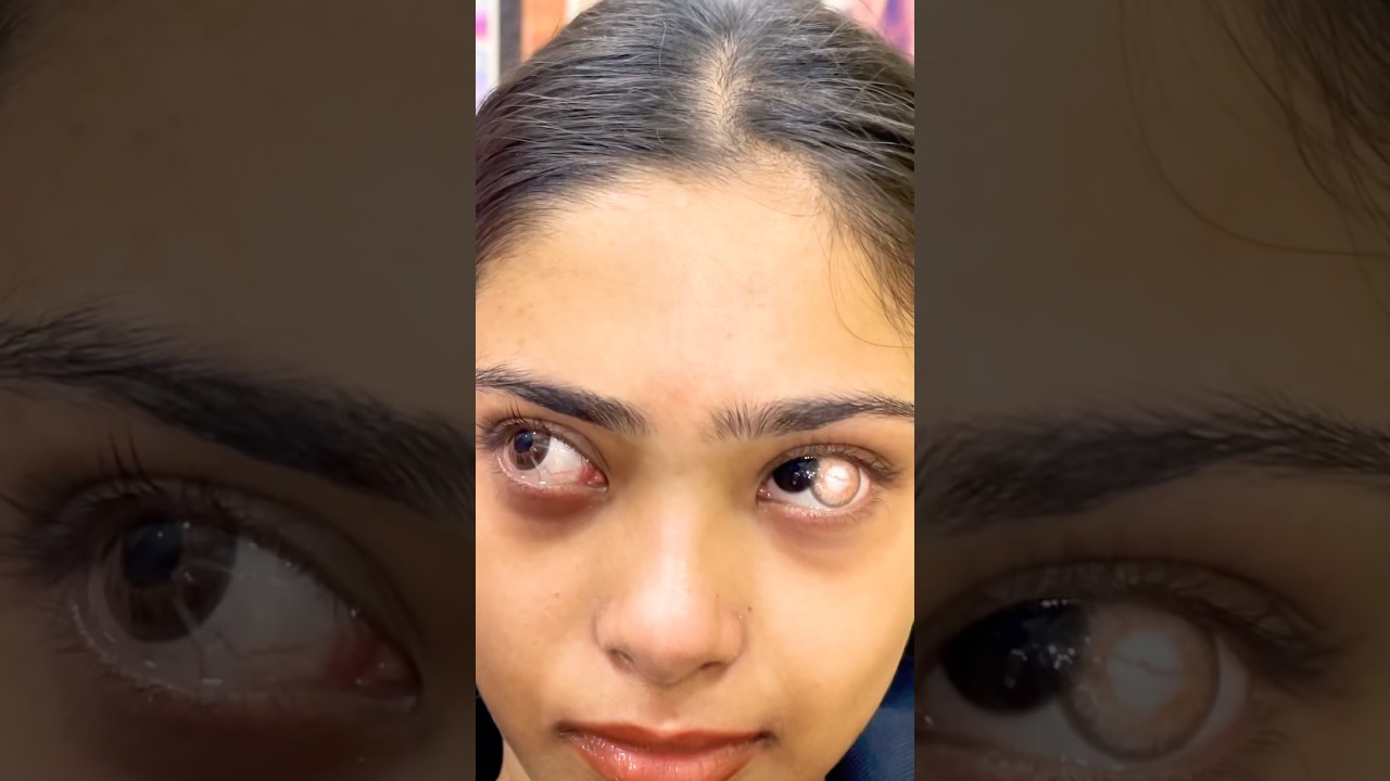 Eye lens tutorial #eyes #eyelenses #trending # #makeup # #eyemakeup #shorts #shortvideo #viral ￼￼