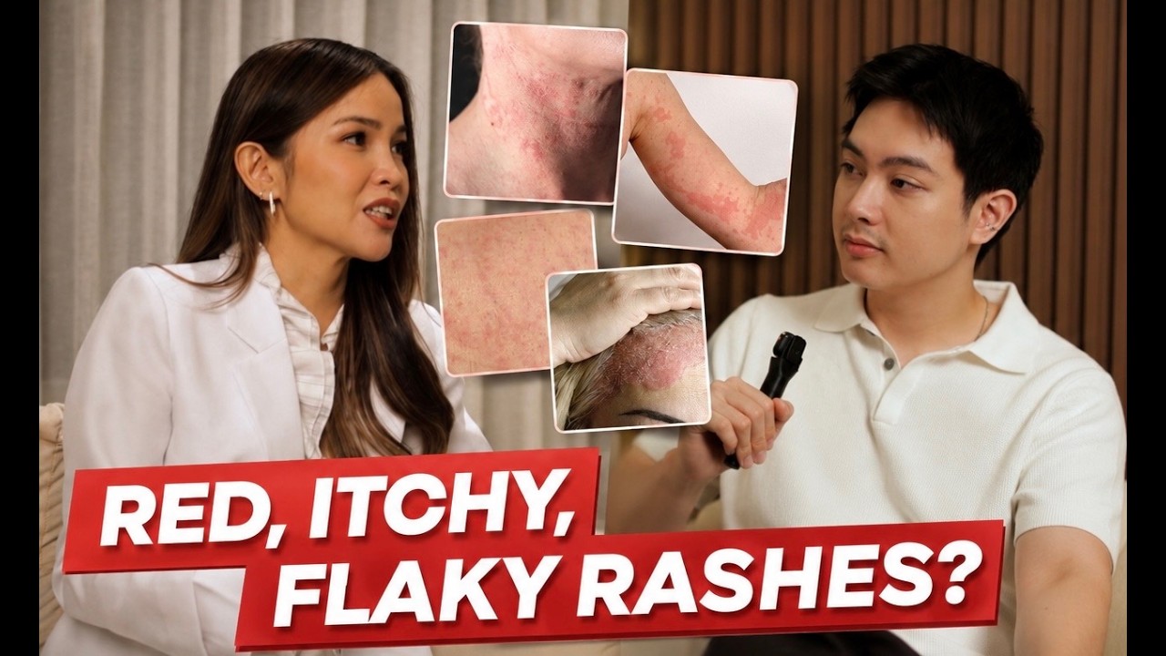 Red, Itchy or Flaky Skin? Dermatologist Explains Eczema, Dermatitis & More! (Filipino)