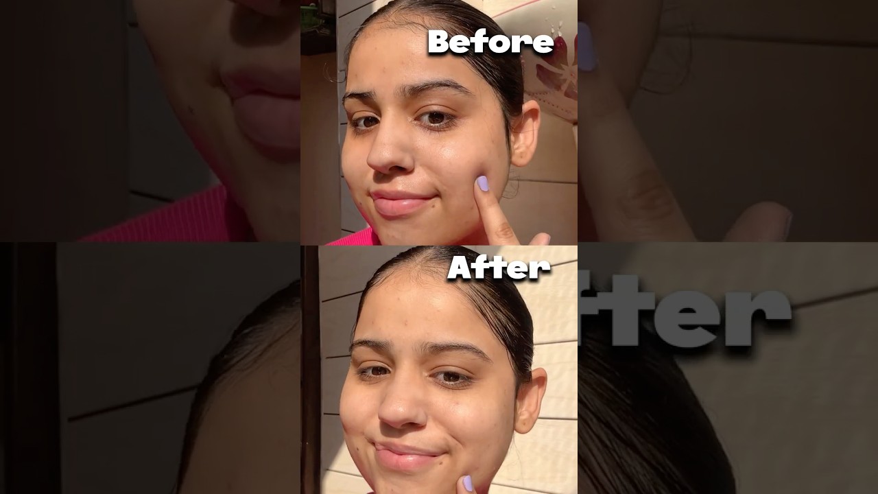 Nila powder for brighter skin #shorts #ytshorts #skincare