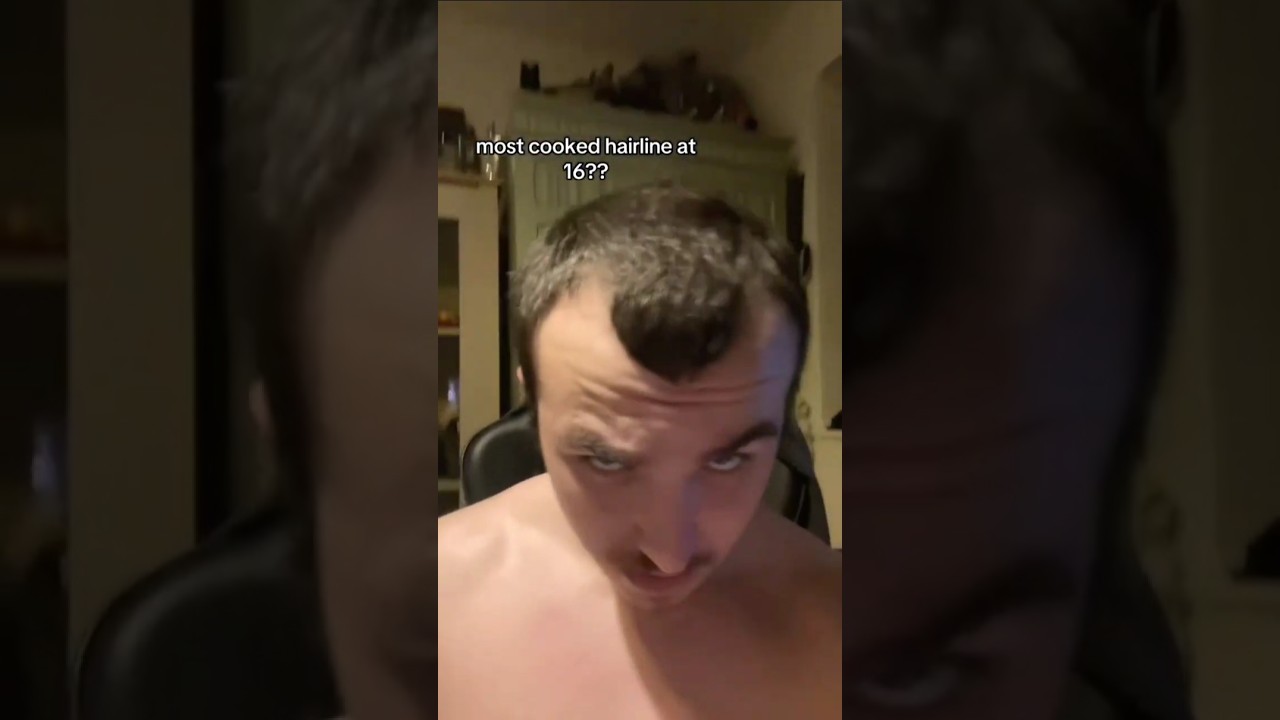 Bro got the whole generation bald 😂 #ytshorts #trending #comedy #looksmaxxing