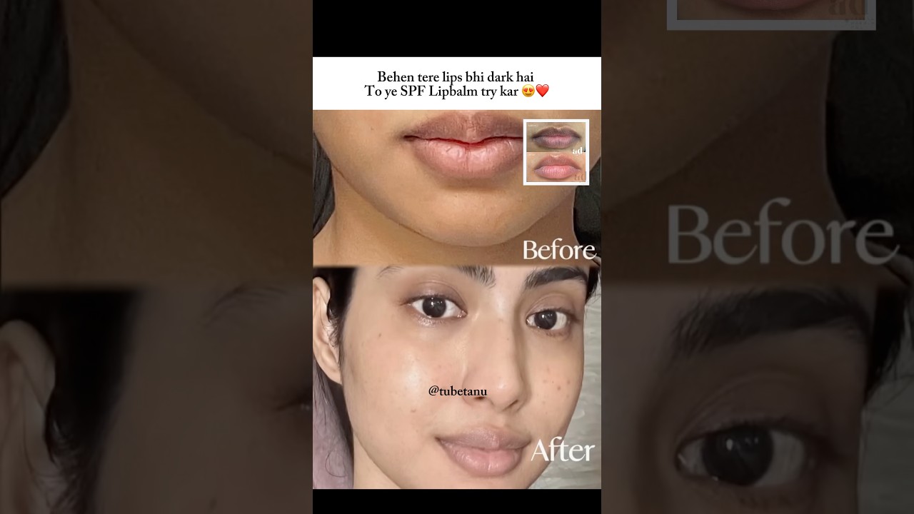 Yashi use this for dark lips 😍❤️100 % results in 1 week | yashi tank #ytshorts #skincare