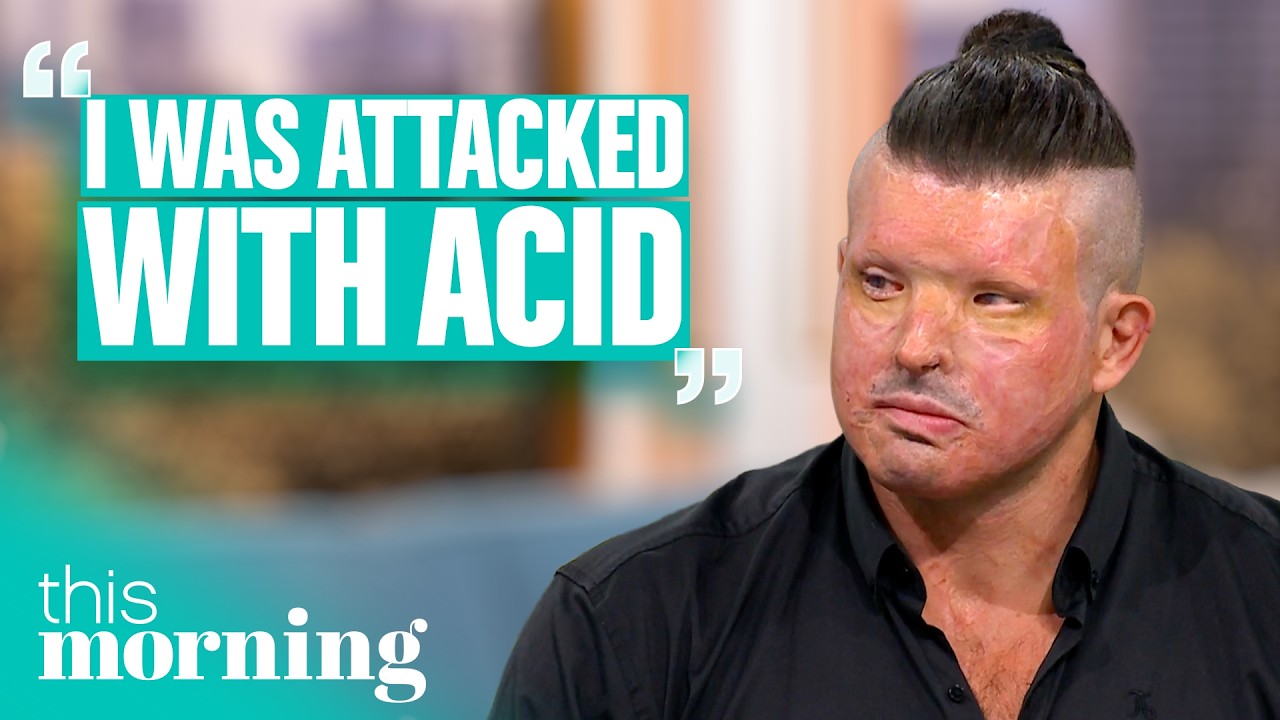 ‘A Stranger Threw Acid in My Face… but I Prefer My Life Now’ | This Morning