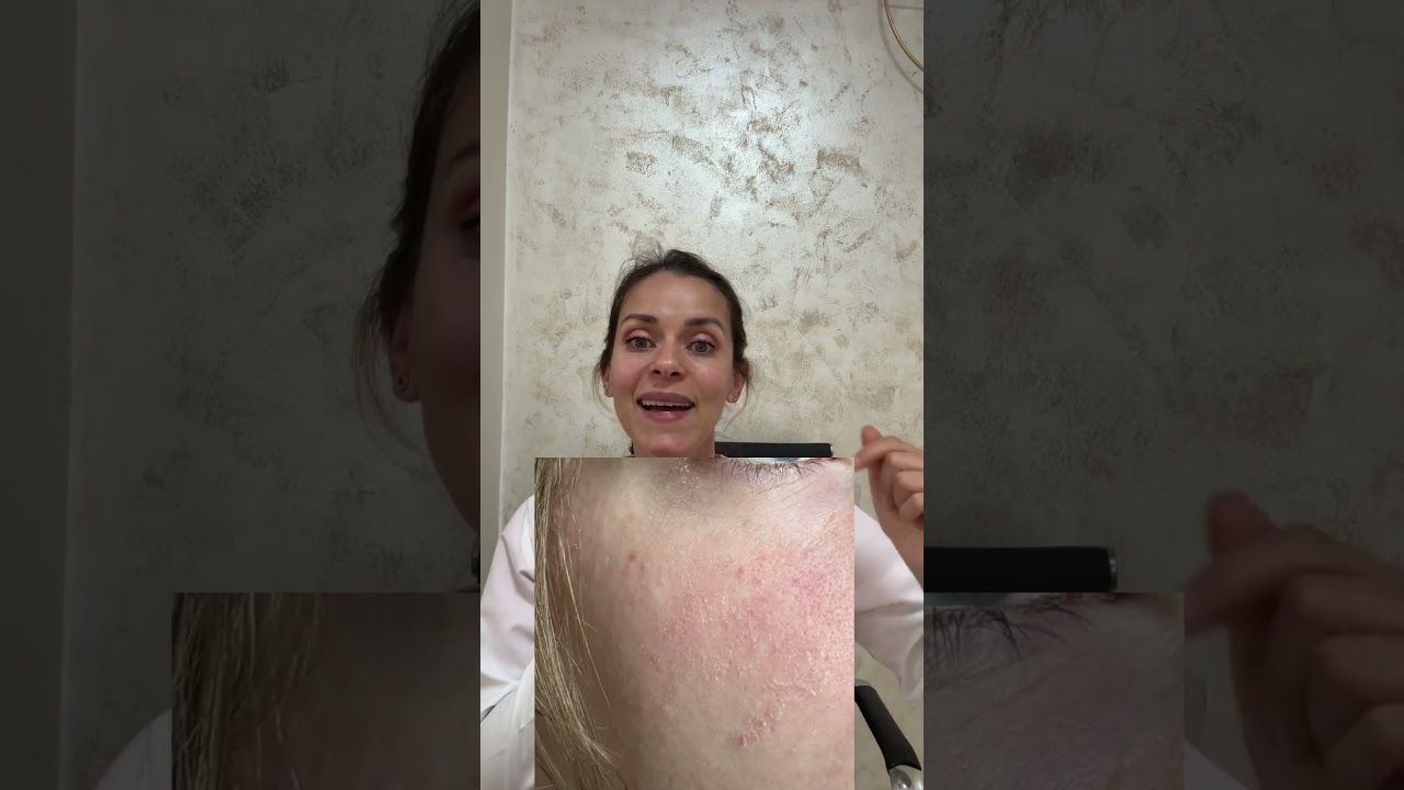 Versión económica vs versión de lujo #skincare