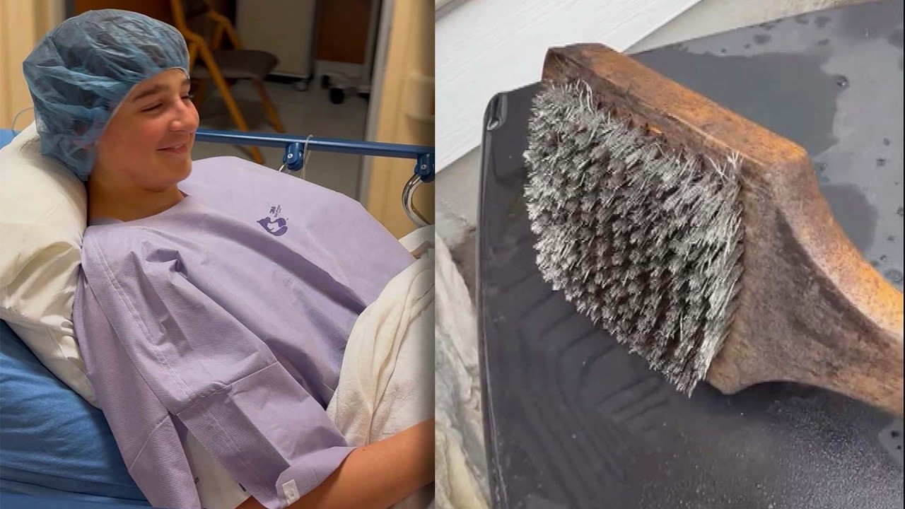 Minnesota Teen Has Emergency Surgery After Swallowing Bristle Brush Needle