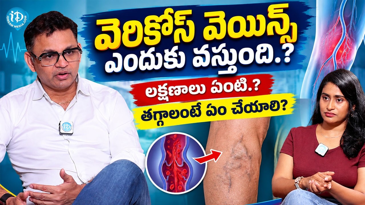 Varicose Veins: Treatment Methods & Complications | Dr. Raja V Koppala | Avis Hospitals | iDream