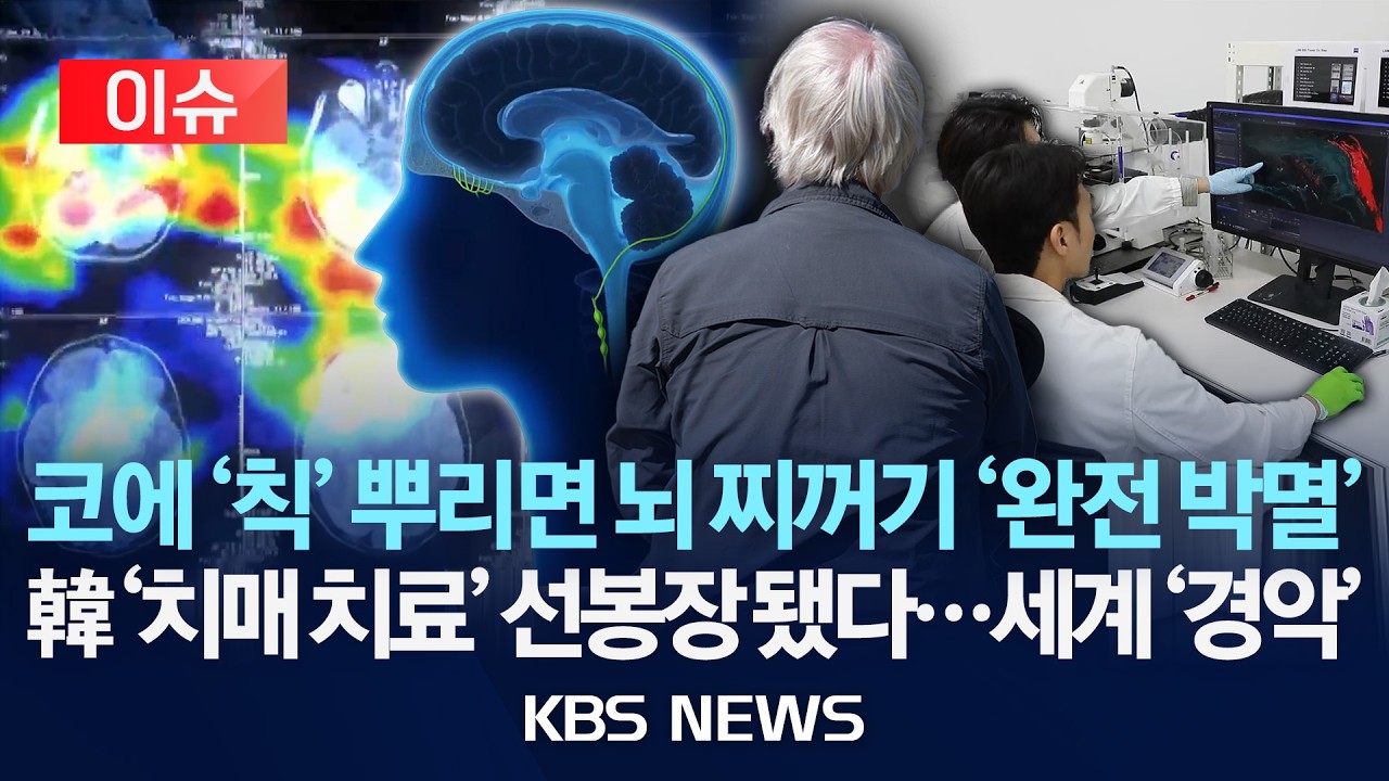 [이슈] 코에 '칙' 뿌리면 뇌 찌꺼기 '박멸'/한국 '치매 치료' 선봉장 됐다…세계 '경악'/2026년 8월 1일(토)/KBS