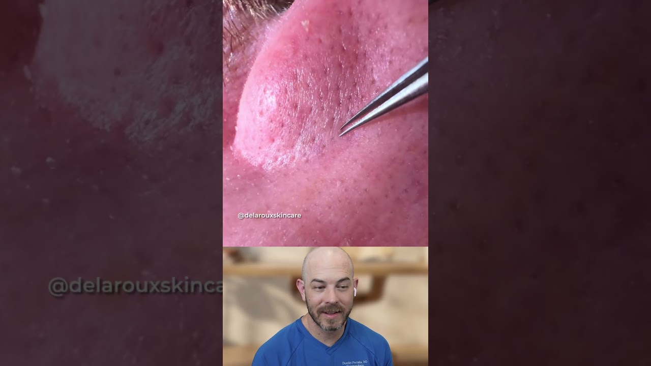 The tweezers are incredible