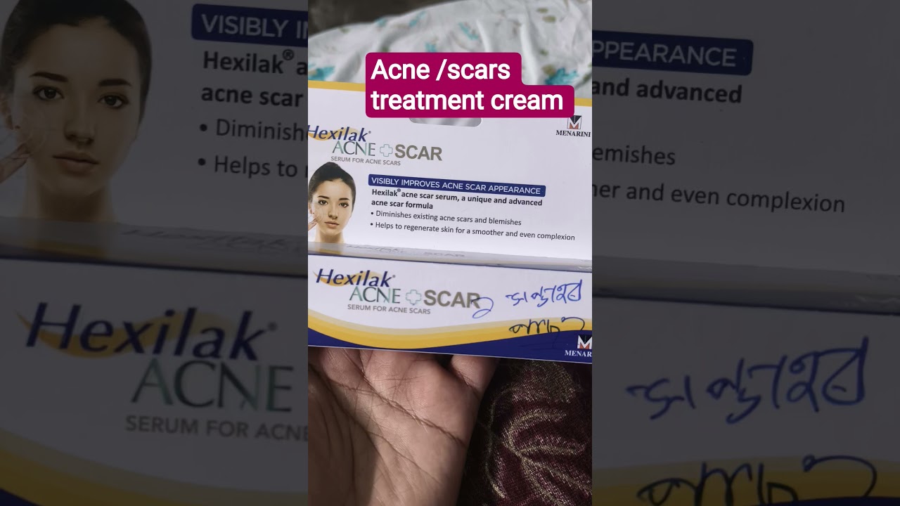 acne scars treatment cream ll#skincare #skincare