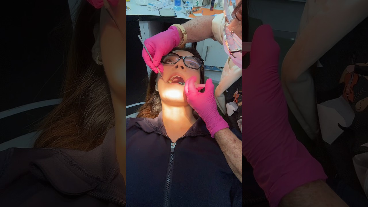 POV: VAS AL DENTISTA 💀
