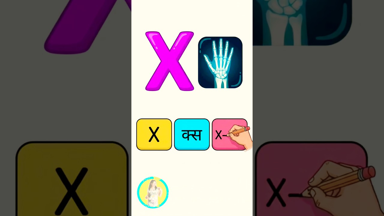 X for X-Ray 🩻 | X एक्स X-Ray | ABC Learning for Kids #Shorts