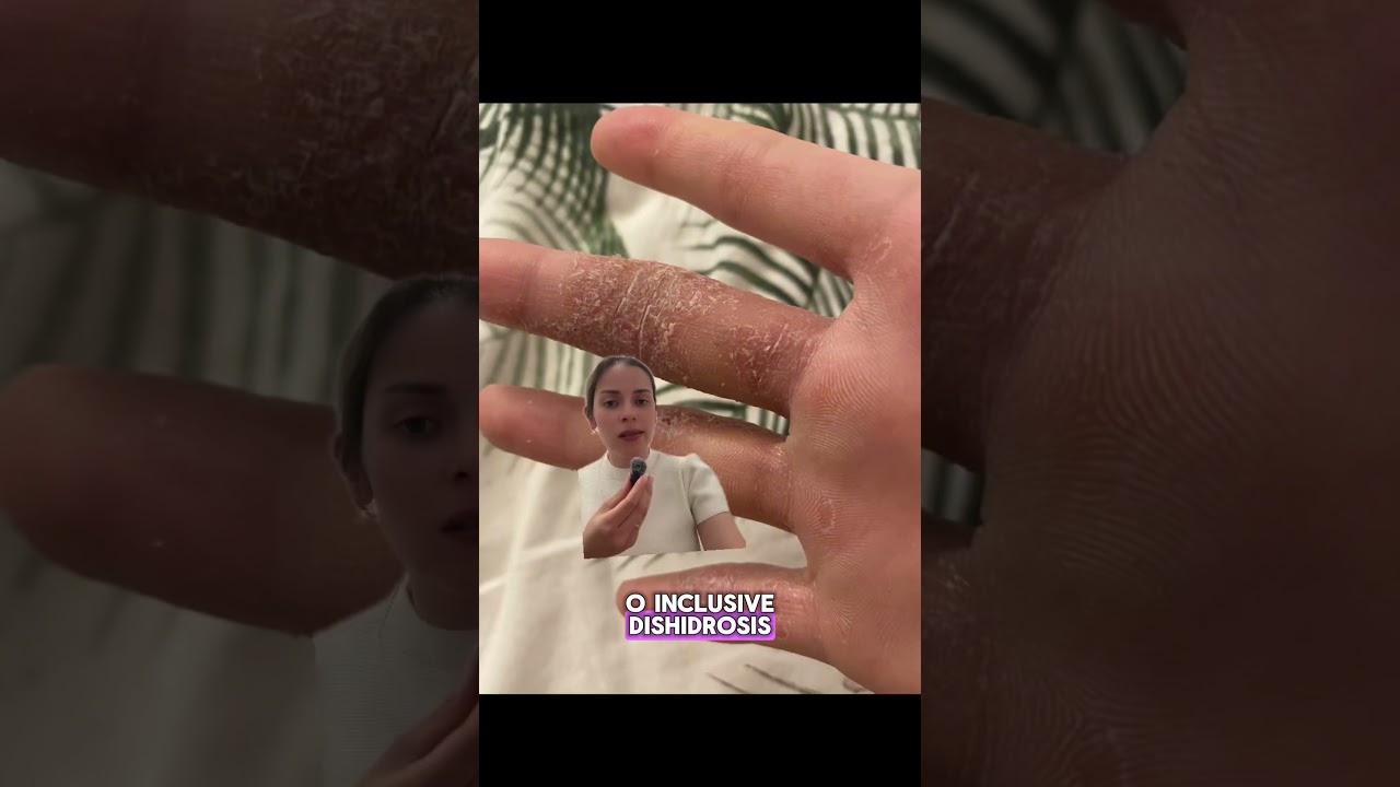 Cómo cuidar tus manos correctamente #handscare