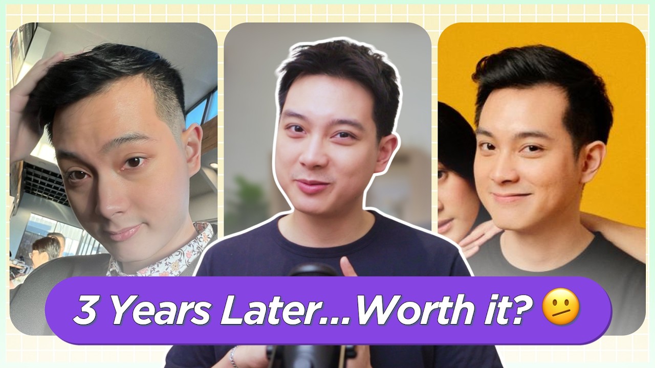 MINOXIDIL & FINASTERIDE: Effective ba for RECEDING HAIRLINE + HAIR LOSS? My Results after 3 YEARS