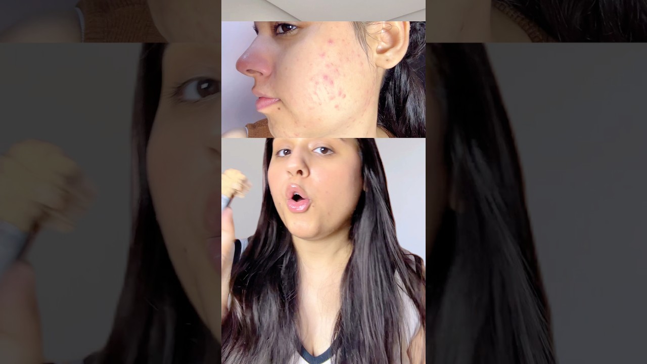 🩵How I Improved My Skin Naturally #skincare #shorts #ytshorts