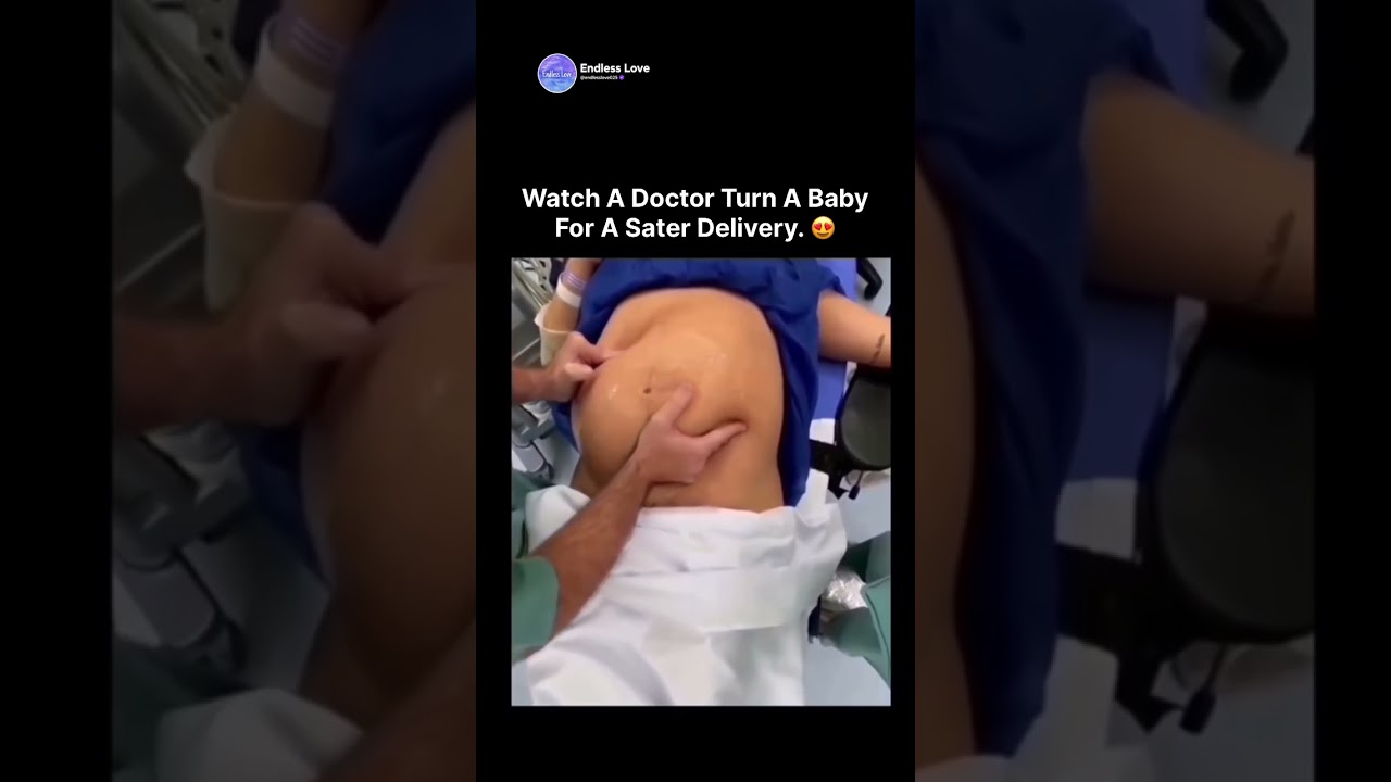 Watch A Doctor Turn A Baby For A Sater Delivery.🤌🤭😍