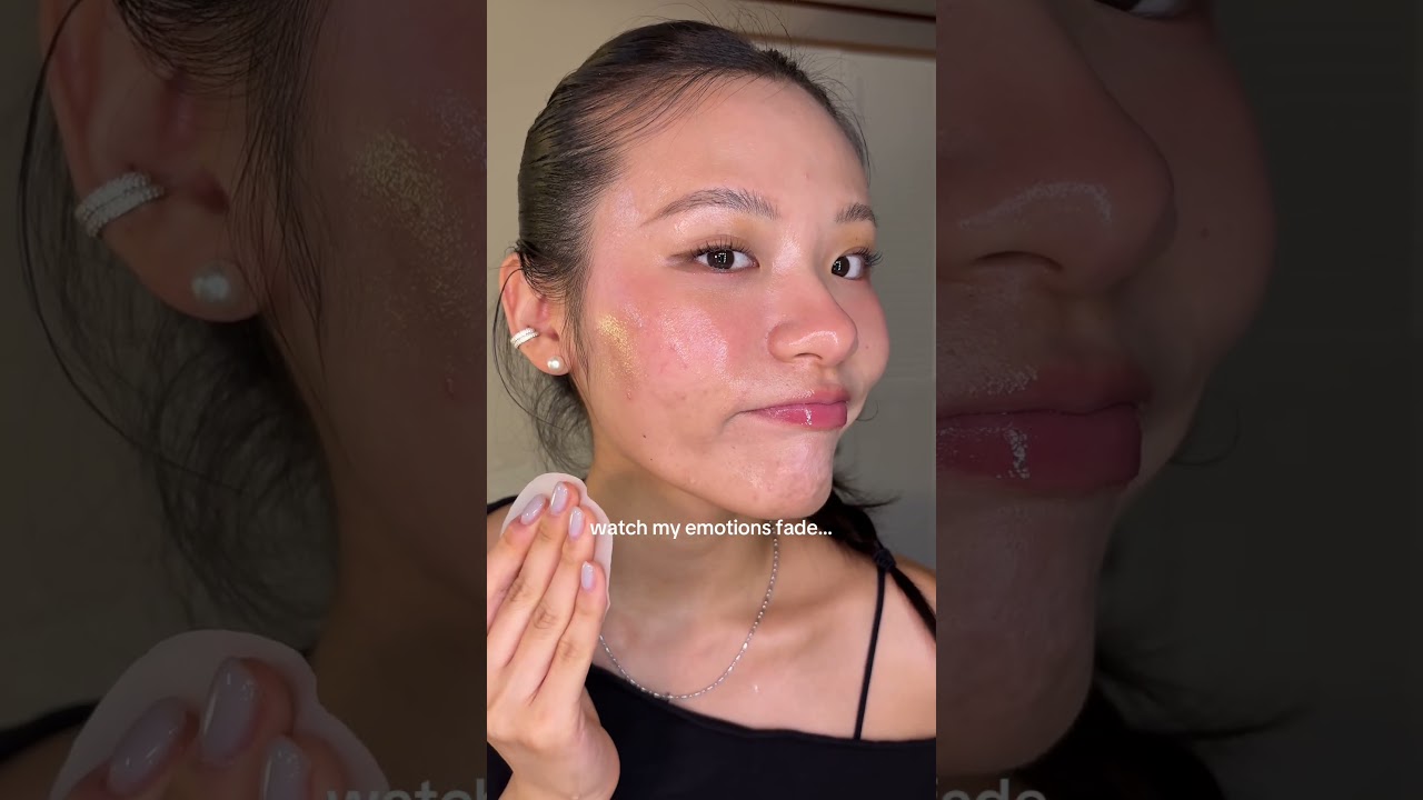 ACNE JOURNEY🥲 #acne