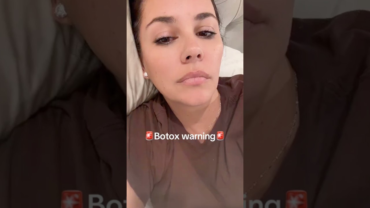 WE'VE BECOME IMMUNE TO BOTOX?! #botox