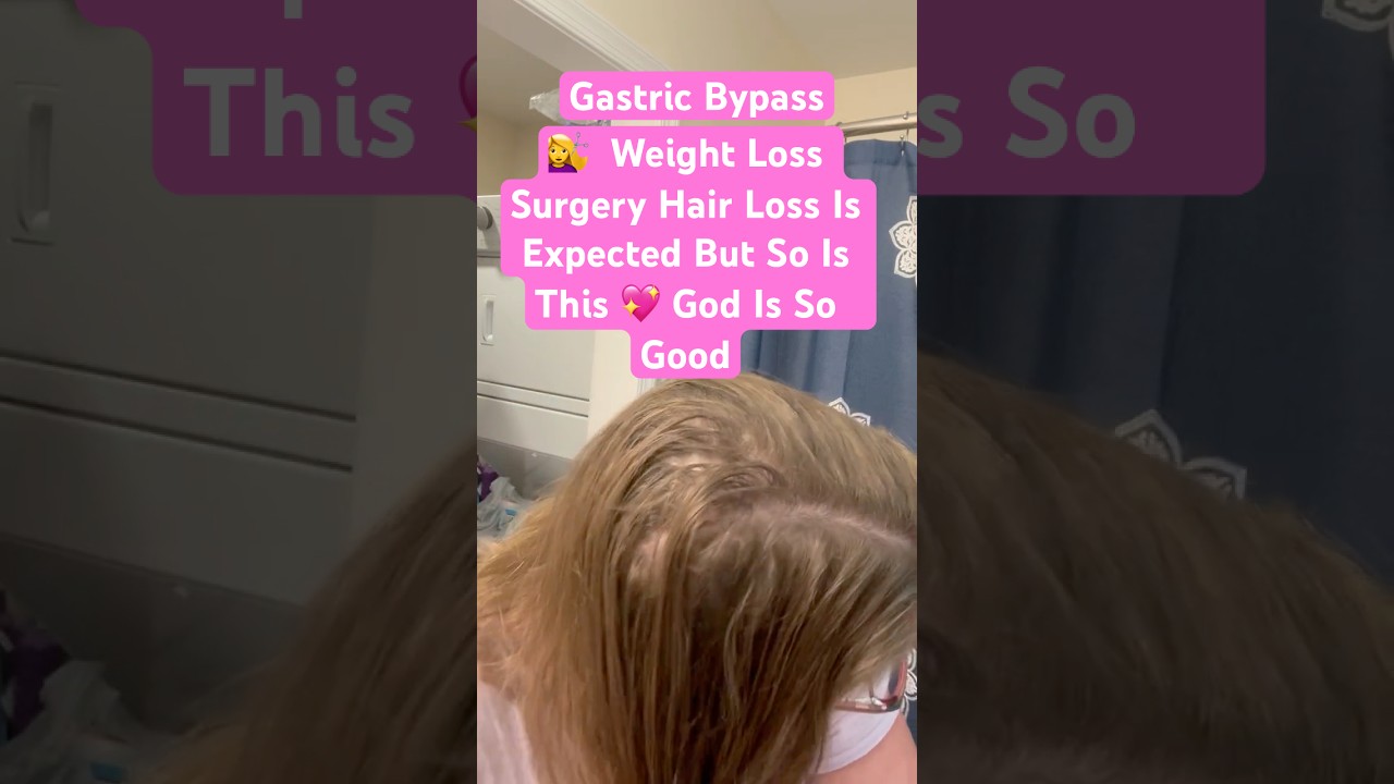 💇‍♀️  Weight Loss Surgery Hair Loss Is Expected But So Is This 💖 God Is So Good