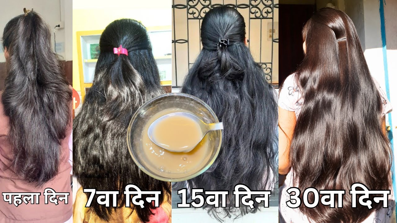 आपके बाल रोज़ाना झड़ते/टूटते है, बाल धोने से पहले लगा लेना, जादू हो जायेगा, पतले बाल घने/लम्बे होंगे