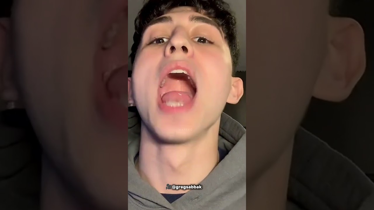 He Hid the Tablet in His Mouth! 😂💊