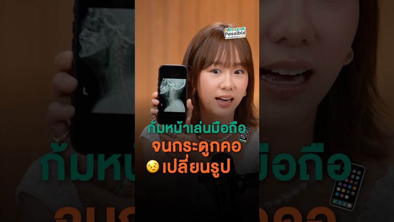 ก้มหน้าเล่นมือถือ จนกระดูกคอเปลี่ยนรูปจากแนวกระดูกคอที่ควรโค้งเล็กน้อย กลับกลายเป็นเกือบตรง!