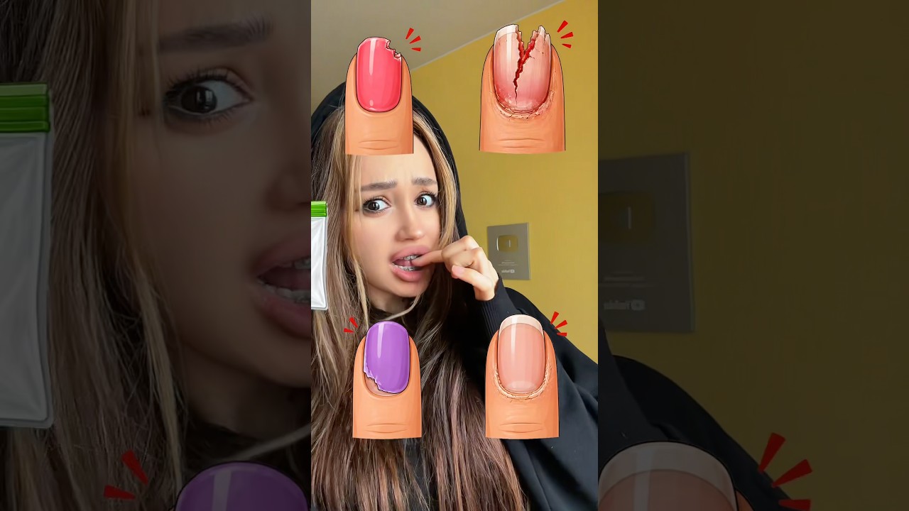 How to win?🫪 #tiktok #shorts