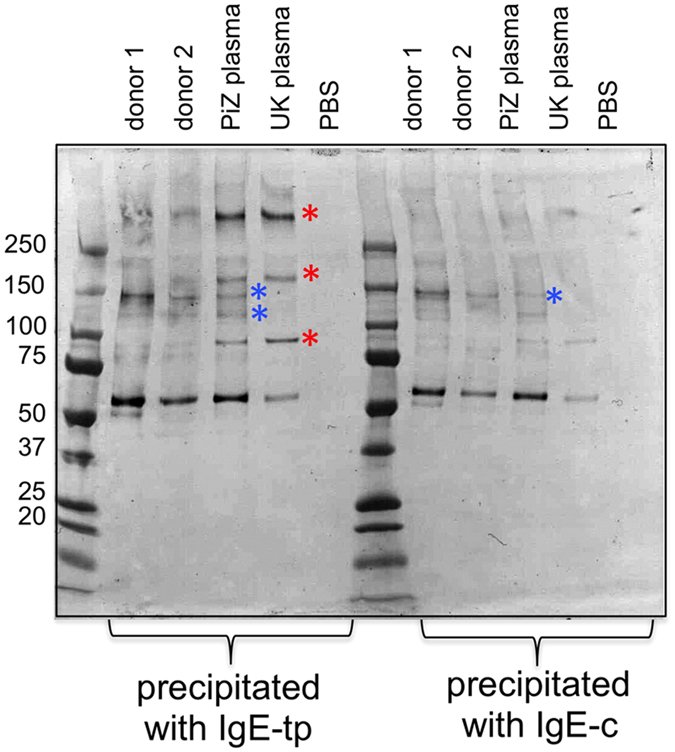 Worm infestations of #Vikings may be root of certain people's predisposition to #emphysema https://t.co/UQhDSlf2fV 
